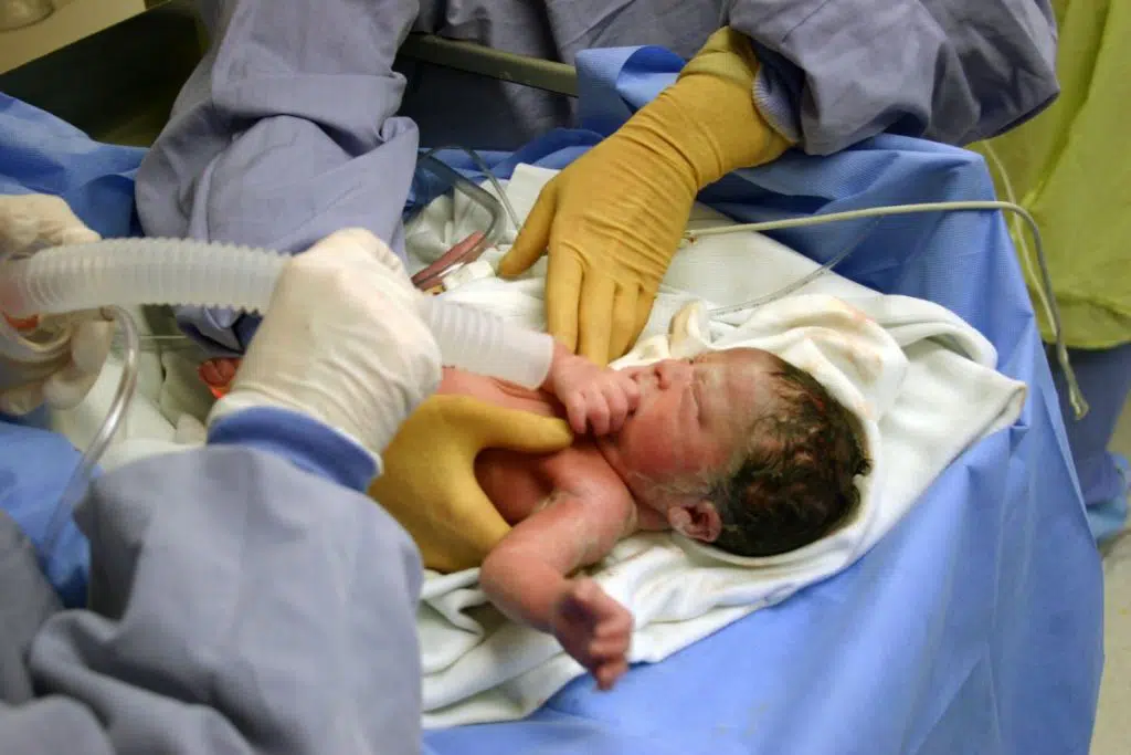 How Birth Trauma Becomes Medical Malpractice