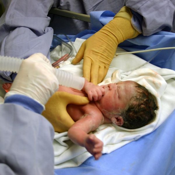 How Birth Trauma Becomes Medical Malpractice